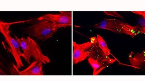 Shrinking Pancreatic Tumors by Starving Their Cellular “Neighbors”