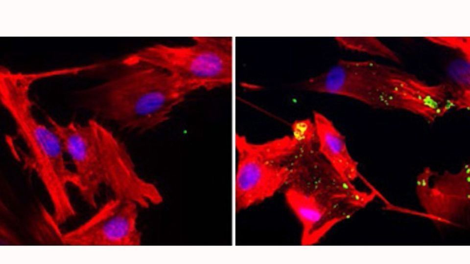 Shrinking Pancreatic Tumors by Starving Their Cellular “Neighbors” content piece image