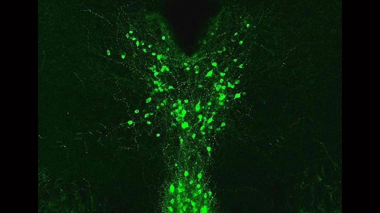 Dopamine Regulates Pain Differently in Male and Female Mice
