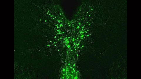 Dopamine Regulates Pain Differently in Male and Female Mice