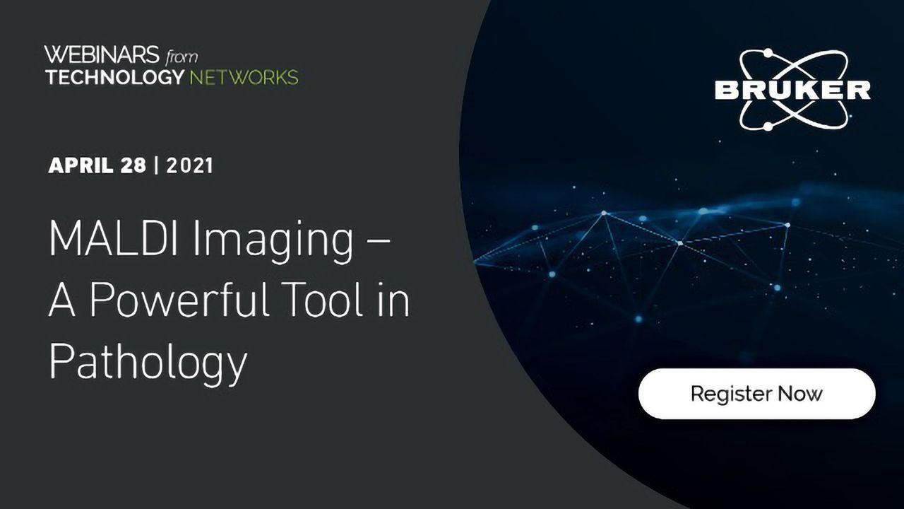 MALDI Imaging – A Powerful Tool in Pathology