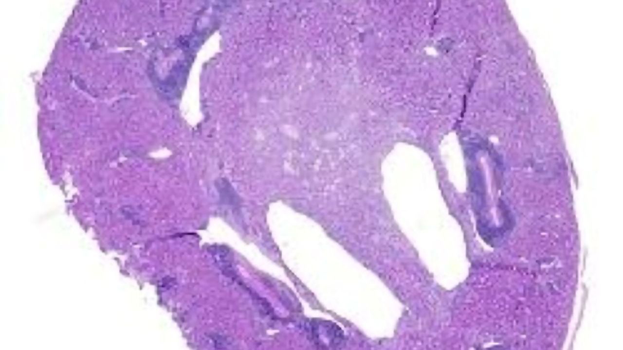 Immune Cells That Contribute to Transplant Rejection Identified