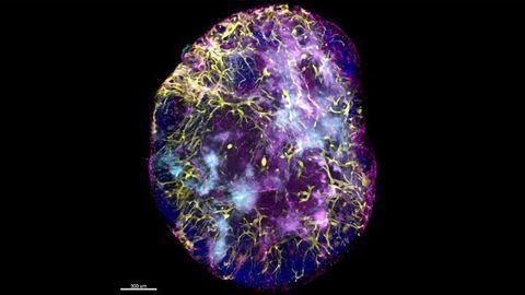 Immune Response Insights Obtained With 3D Imaging