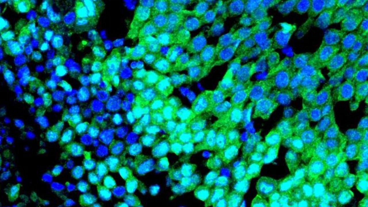 Team Discovers a Detonating Fuse for Basal-Like Breast Cancer
