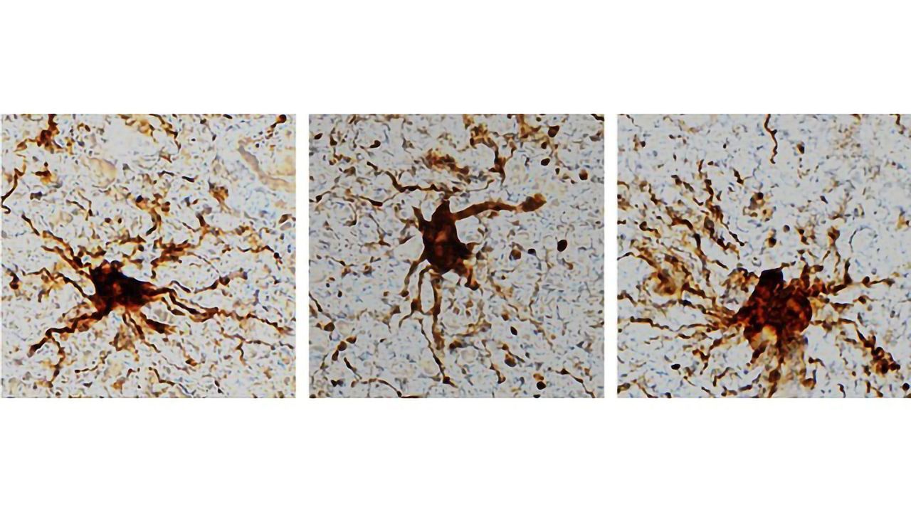 "Zombie" Brain Genes Discovered That Come to Life After Death