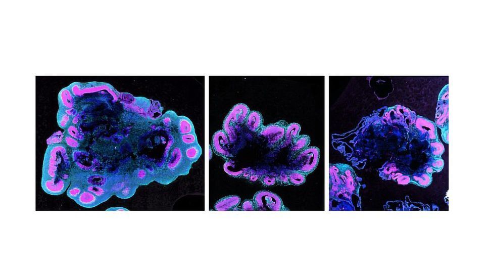 Researchers Discover Why Human Brains Are So Big content piece image