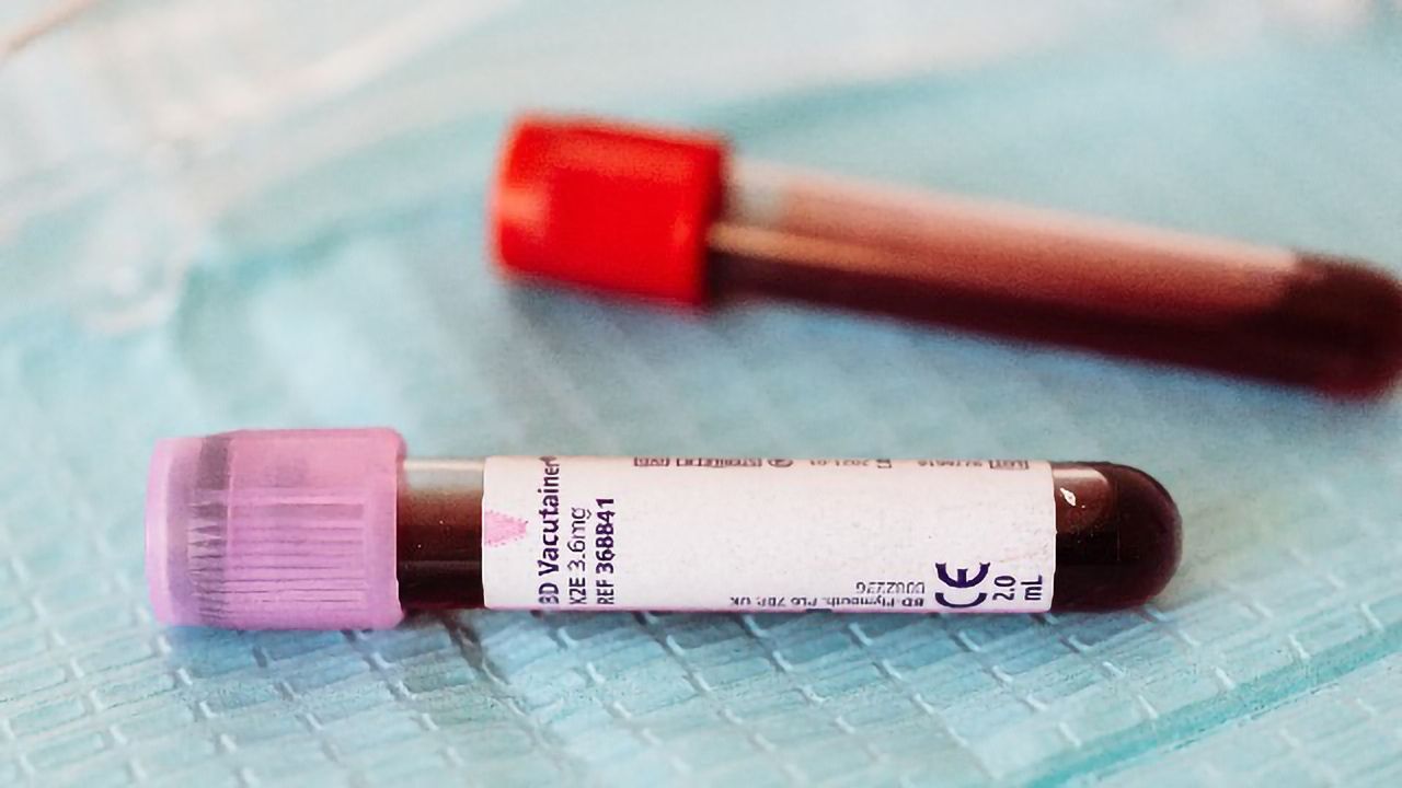 Blood Test Enables Accurate Monitoring of Multiple Myeloma Patients