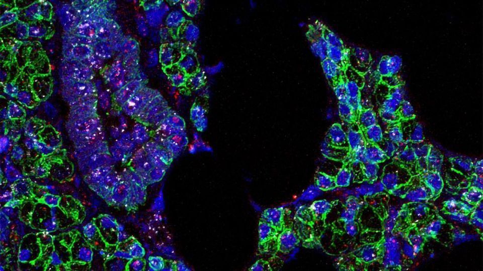 SARS-CoV-2 Infects Cells in the Mouth, Study Shows content piece image