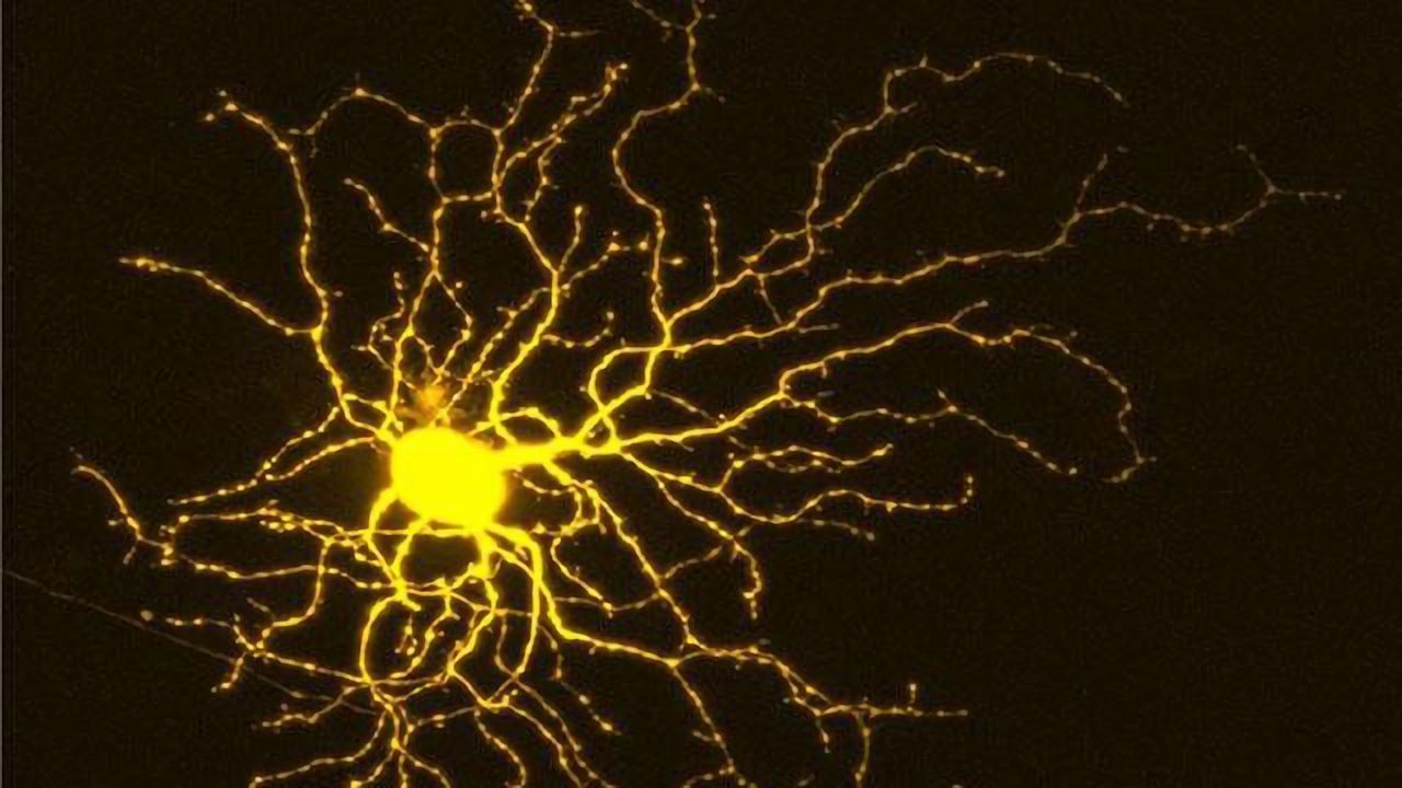 Retinal Ganglion Cell