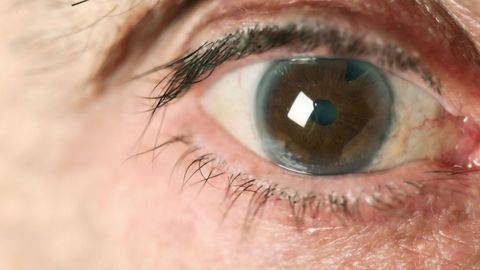 Low-Tension Glaucoma Linked to Cognitive Impairment | Technology Networks