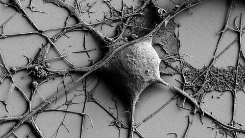 Variations in Herpes Infection Symptoms May Be Linked to Gene Expression Differences
