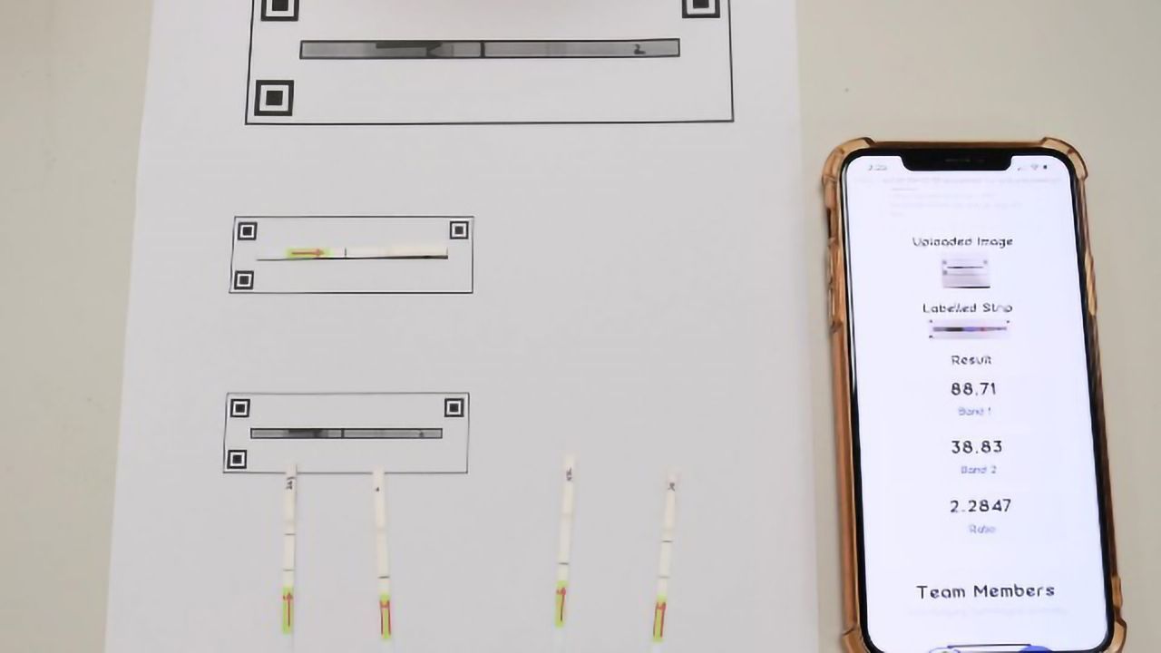 CRISPR-Based Test Can Detect SARS-CoV-2 Variants