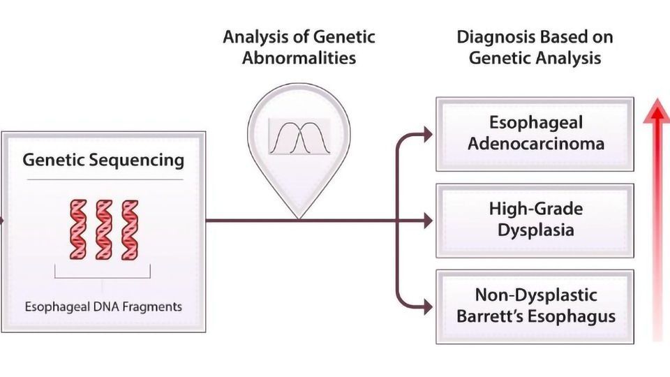Esophageal Brushing and Genetic Sequencing Identify Patients With High Cancer Risk content piece image