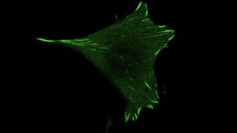 Cells Rely on Their Crampons To Avoid Slipping