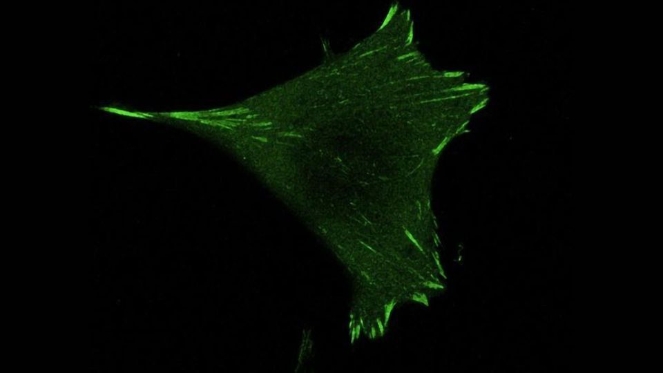 Cells Rely on Their Crampons To Avoid Slipping content piece image