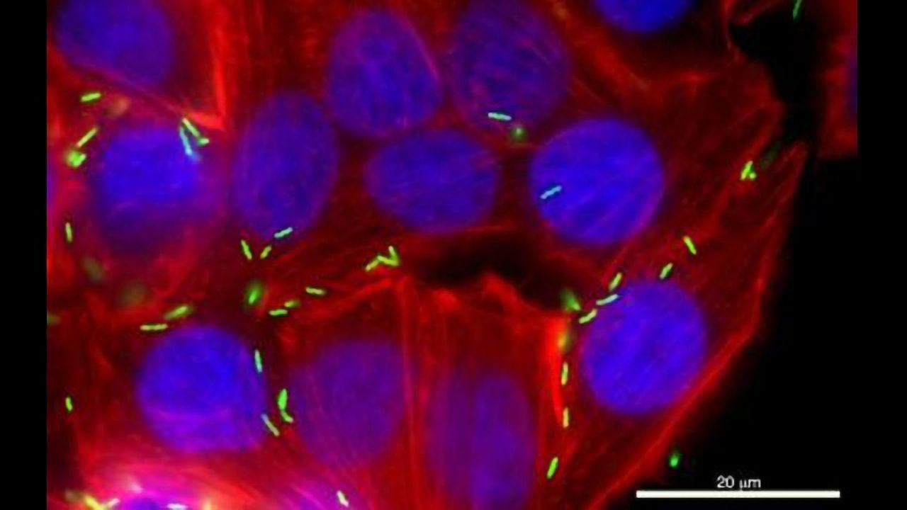 Protein May Be Key to Blocking Food Poisoning Bacterium