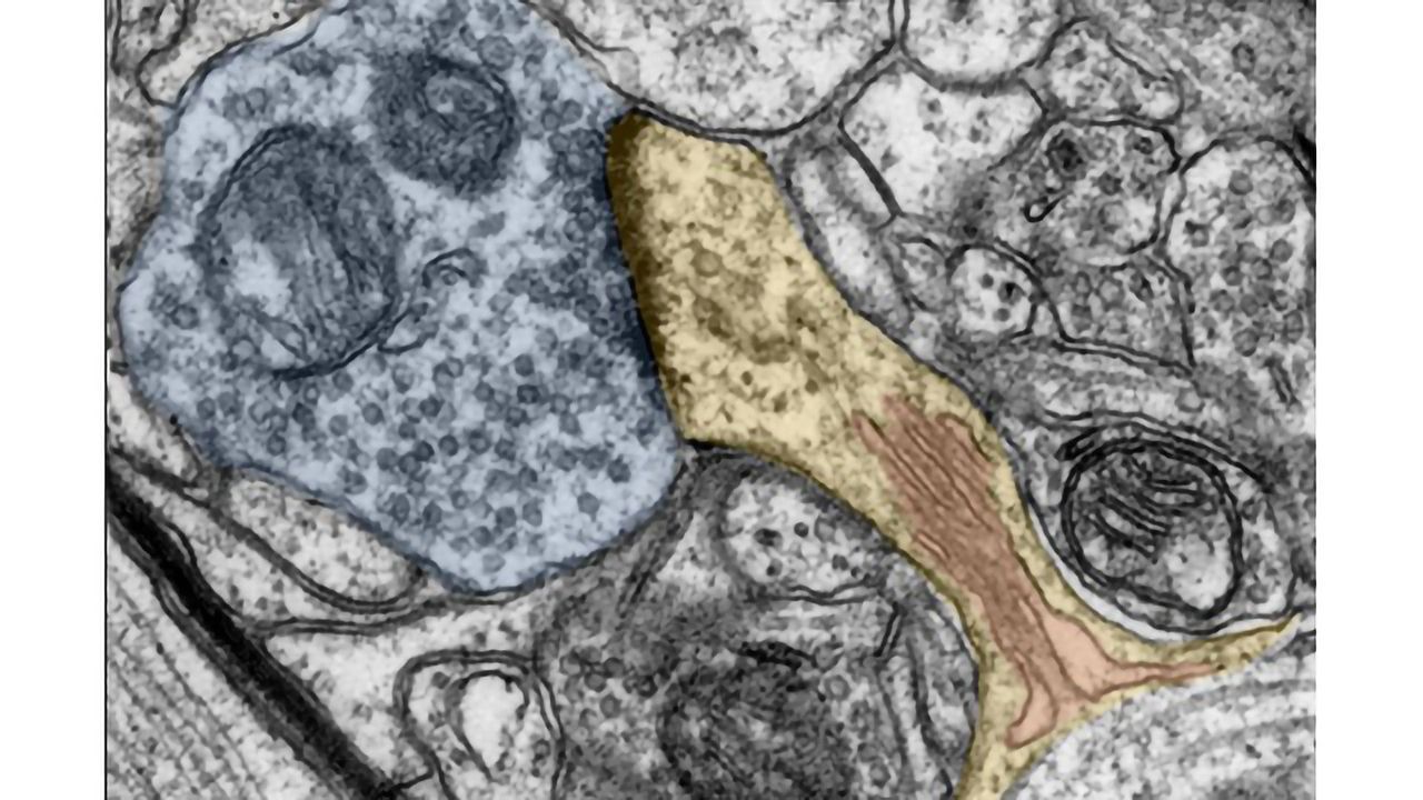 Vitamin A Metabolite Important for Neuroplasticity?