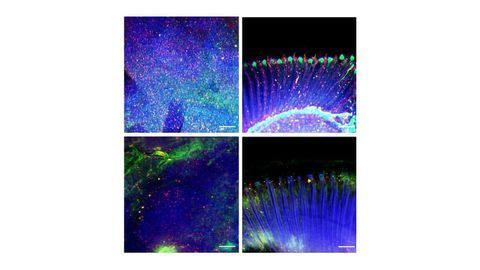 Signals From Skeletal Muscle Protect Against Dementia