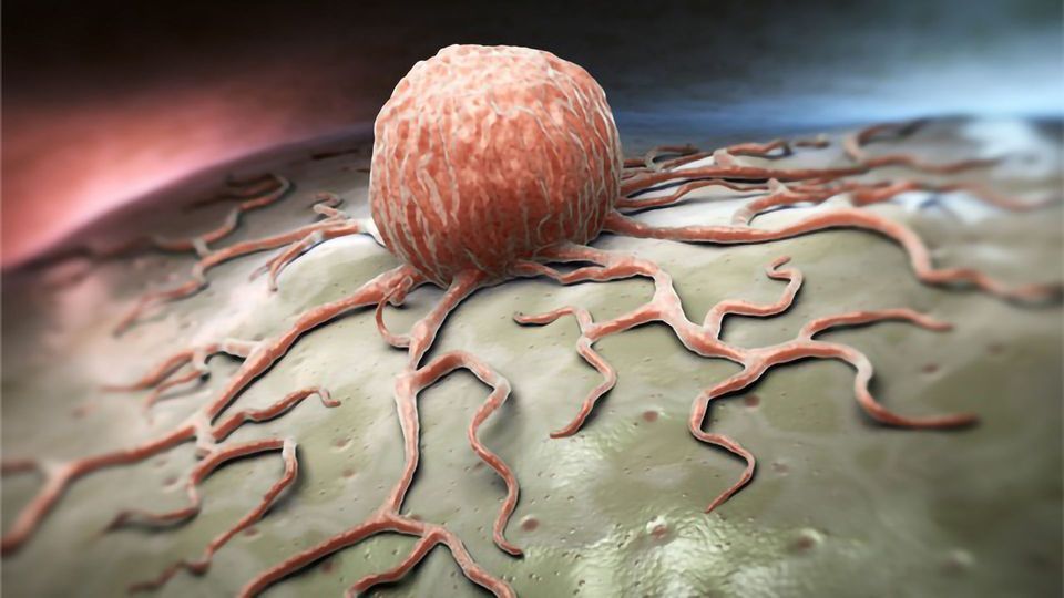 “Nuclear Speckles” Inside Cells May Play a Role in Some Cancers content piece image