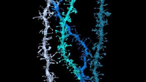 Vitamin Derivative Makes for a More Plastic Brain