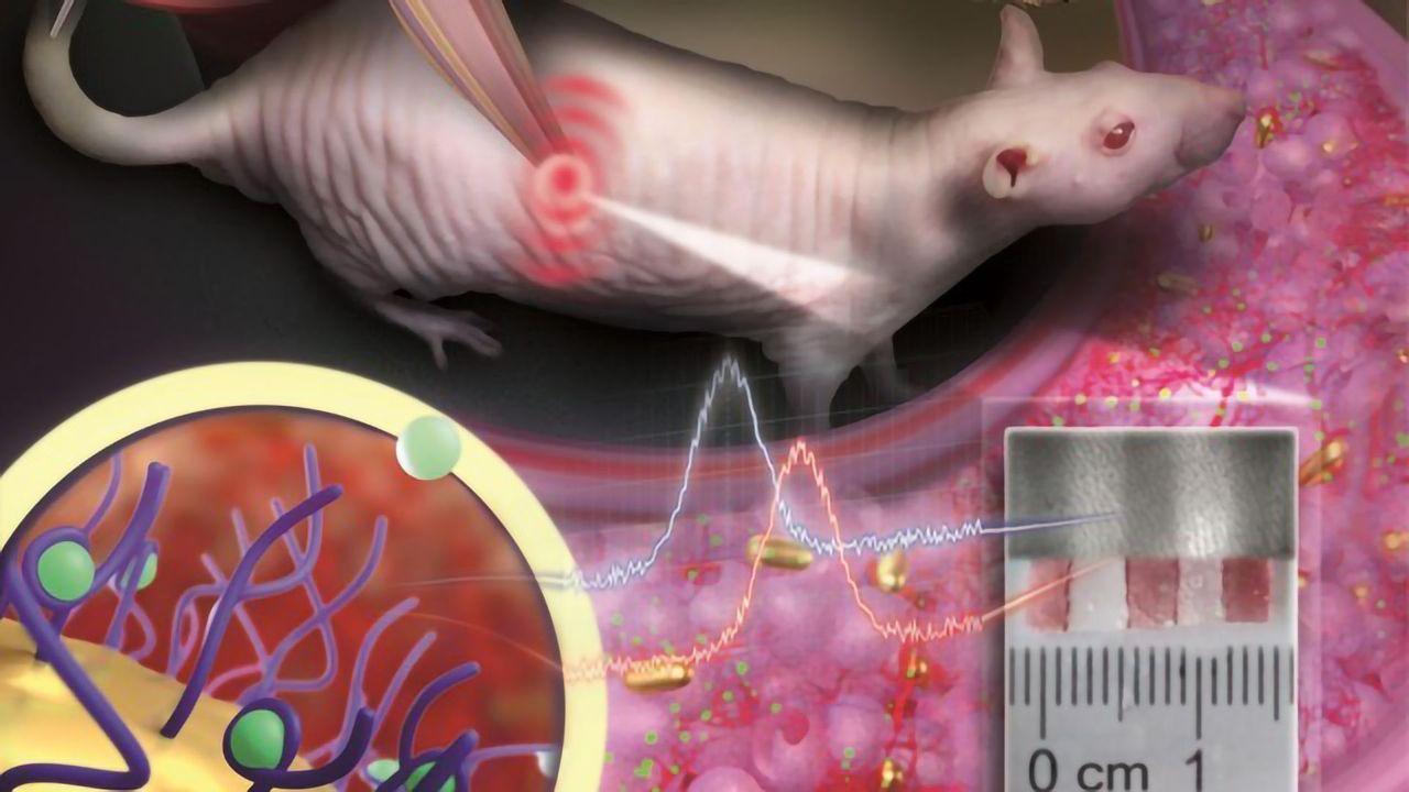 Nanoparticle “Tattoo” Changes Color in Response to Drug Concentration in the Blood