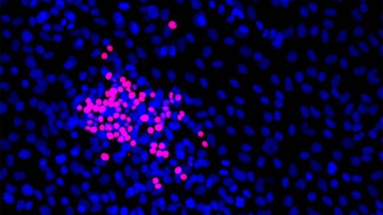 Two New Ways To Tackle Small Cell Lung Cancer