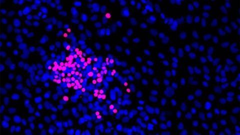 Two New Ways To Tackle Small Cell Lung Cancer