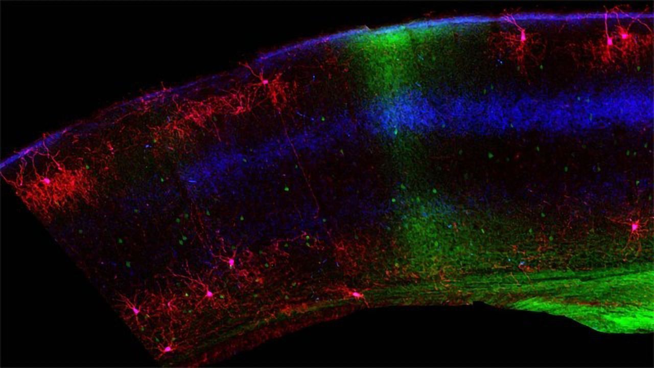 Mouse Chandelier Cells