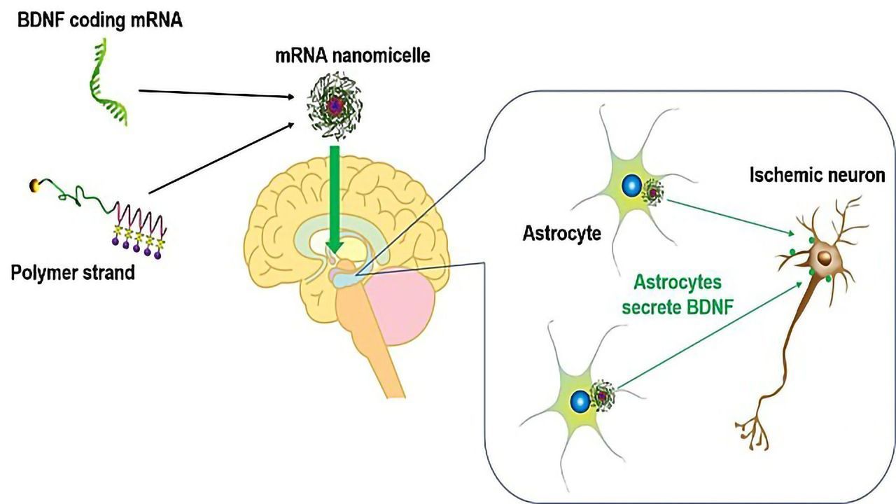 mRNA Delivery System Produces Therapeutic Protein in Rat Brains