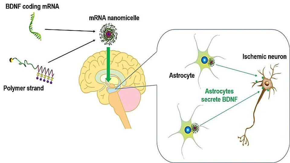mRNA Delivery System Produces Therapeutic Protein in Rat Brains content piece image