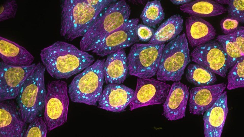 Predicting the Biological Language of Cancer and Alzheimer's Using AI content piece image