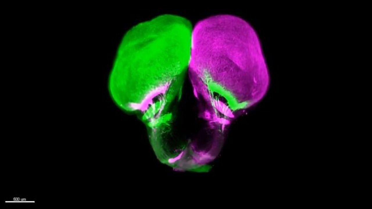 A New Look at Fish Eyes Rewrites the Textbook on Brain Development