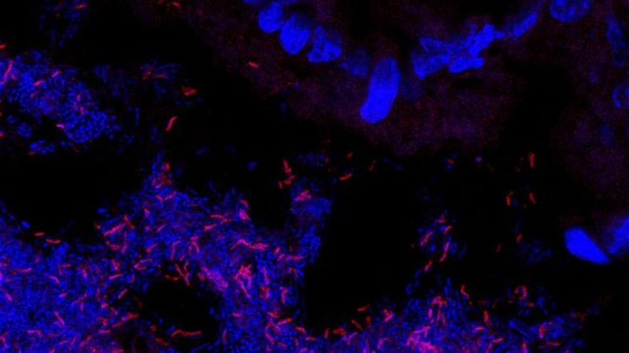 Sulfur Compounds in Green Vegetables Promote Growth of Important Gut Bacteria