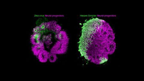 Brain Organoids Show How Viruses Can Impair Development