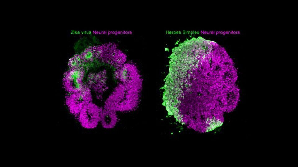 Brain Organoids Show How Viruses Can Impair Development content piece image