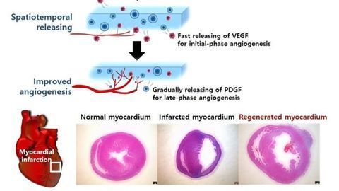 Adhesive Patch Delivers Blood Vessel-Forming Factors to Damaged Tissues