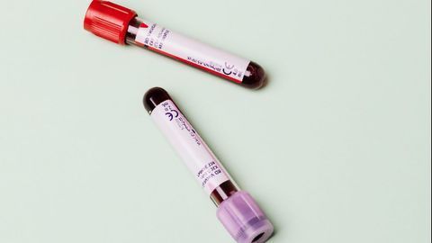 Cancer DNA Blood Tests Independently Validated