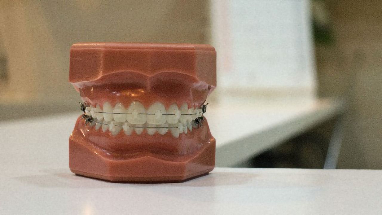 Gum Bacteria Imbalance Linked to Alzheimer's Biomarker
