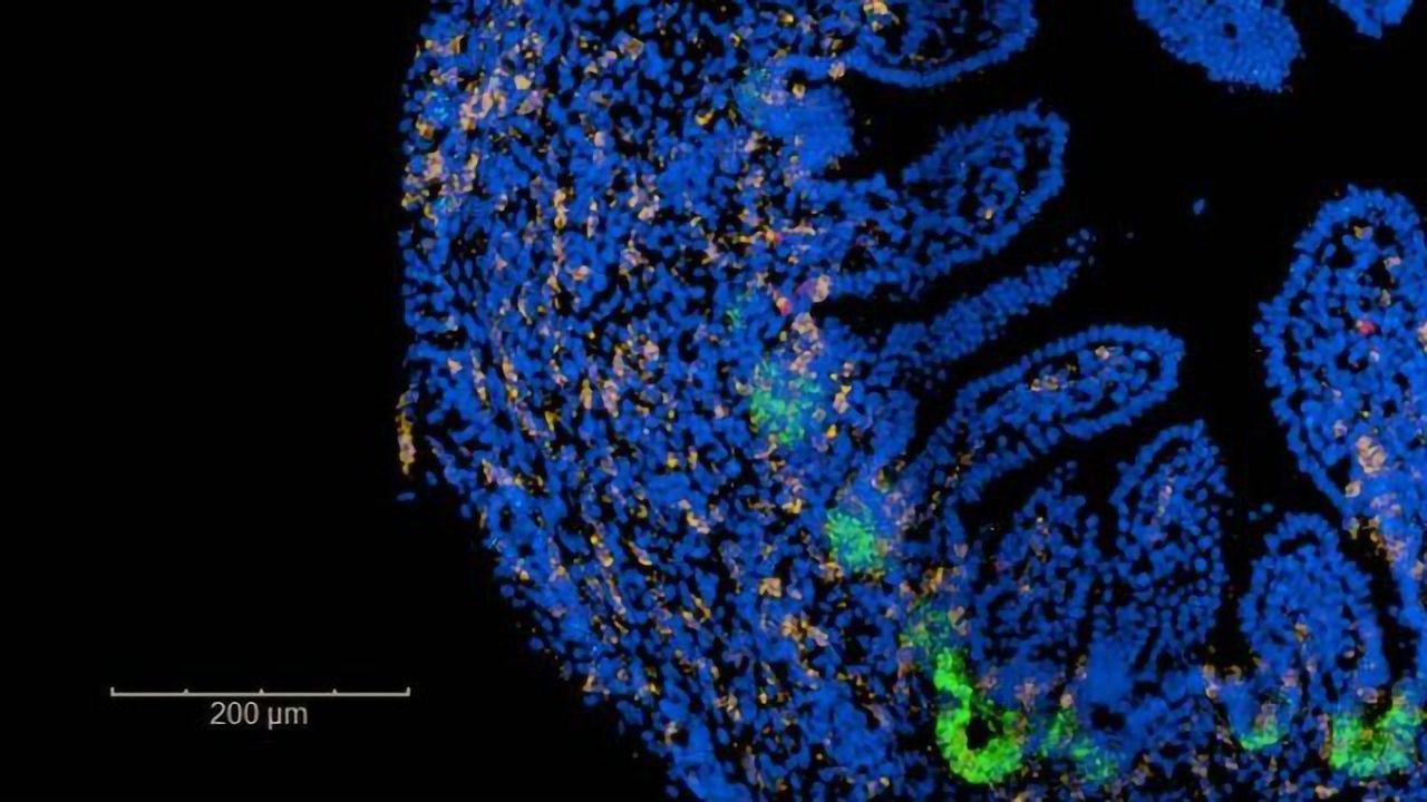Emerging Intestinal Villi