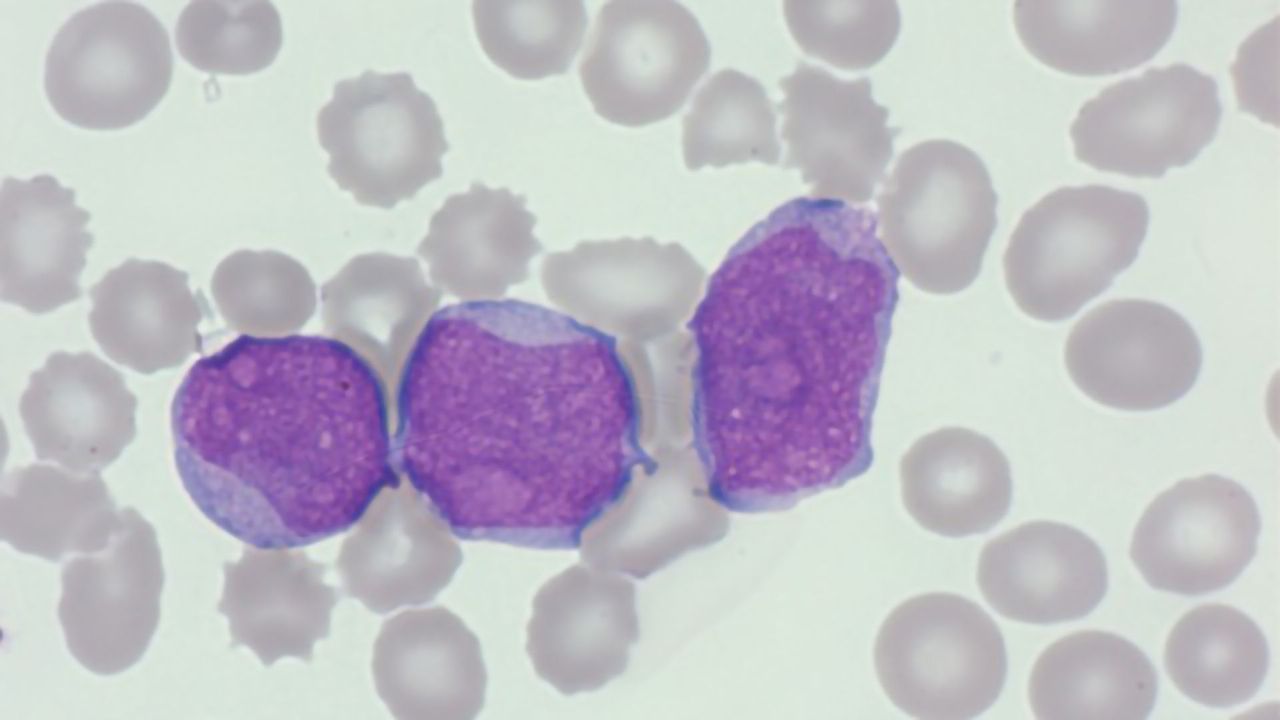 HORIBA Medical To Present Webinar Discussing Blood Cell Morphology Basics
