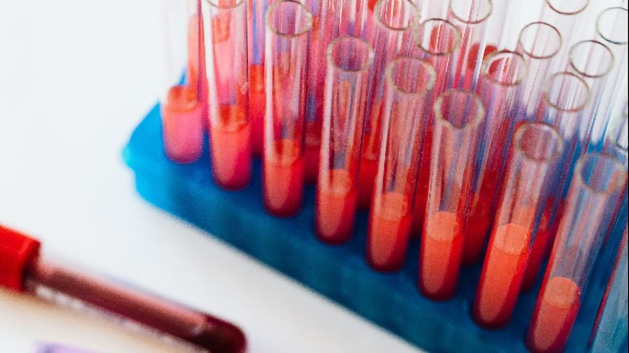 Blood Test Detects Marker of Metastatic Cancers, Infection and Neurological Disease