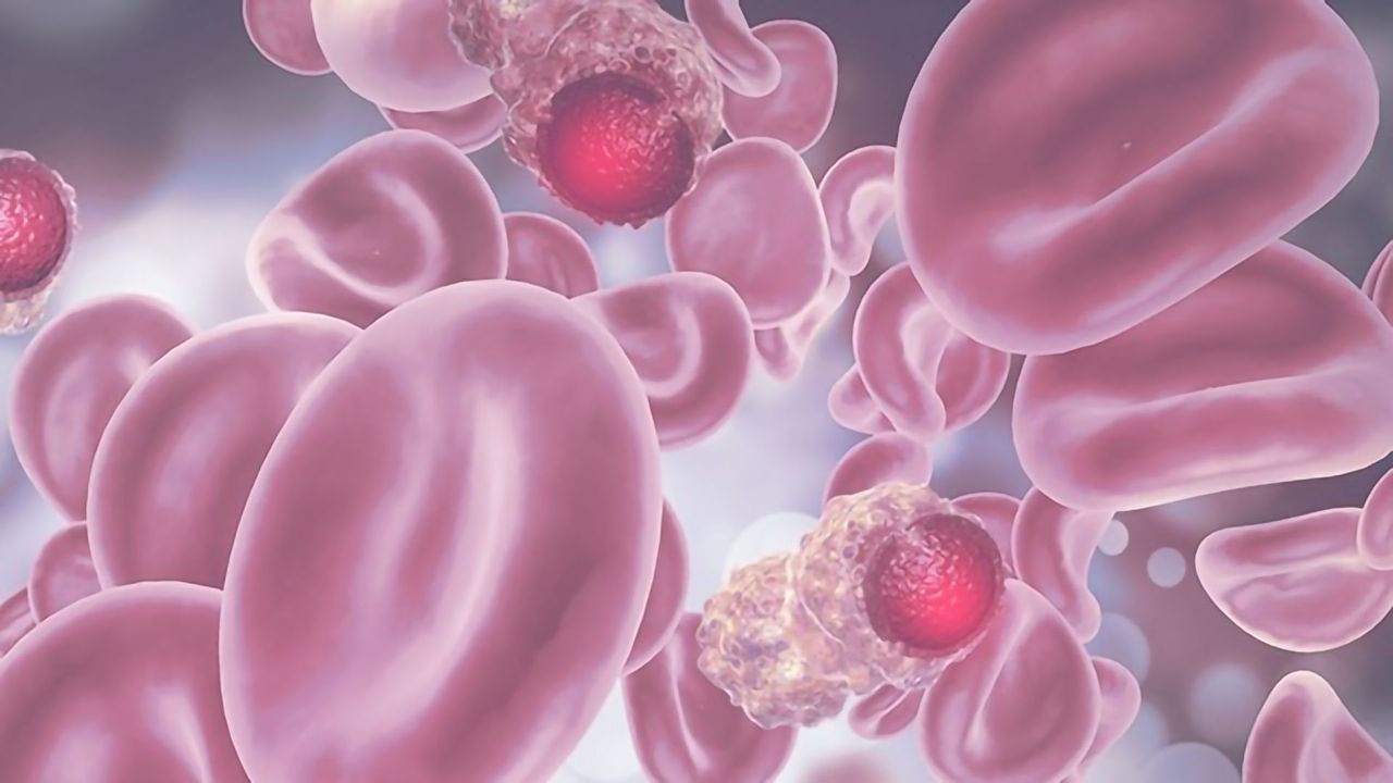 Detecting Residual Cancer Using Whole-Genome Sequencing and Artificial Intelligence
