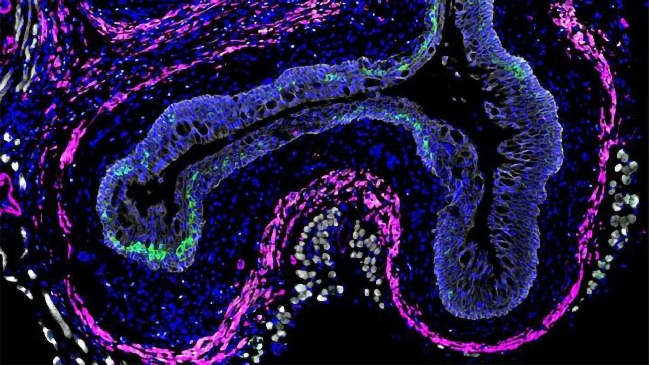 Intestinal Worms Can Impair Immune Response Elsewhere