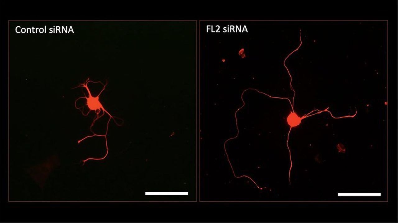 Drug May Help To Regenerate Erectile Nerves Damaged by Prostate Surgery