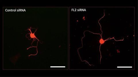 Drug May Help To Regenerate Erectile Nerves Damaged by Prostate Surgery