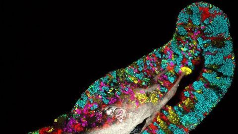 Is Microbial Diversity Decreasing Like Animals and Plants?