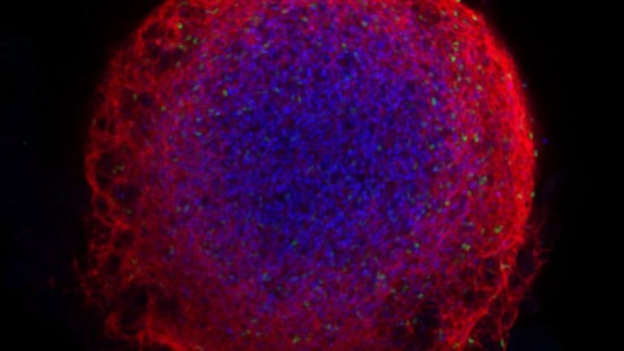 Best Practices for Pipetting 3D Cell Culture Hydrogels