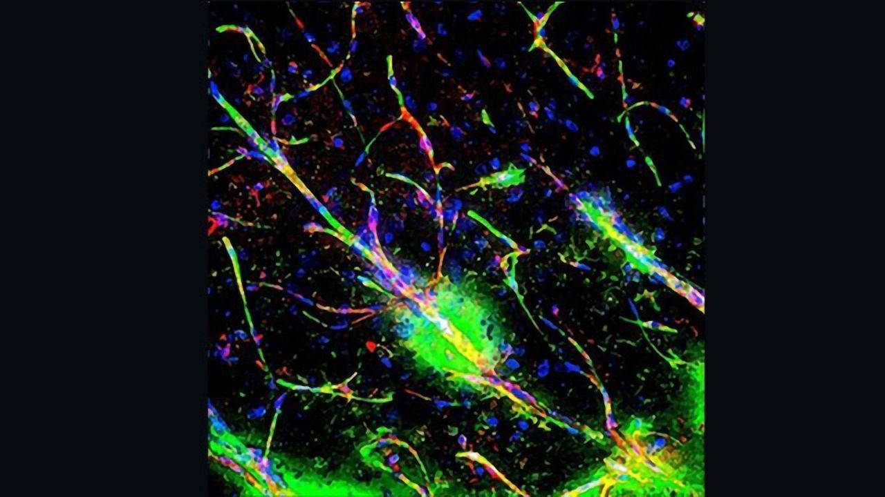 Our Immune System Links the Blood-Brain Barrier to Schizophrenia
