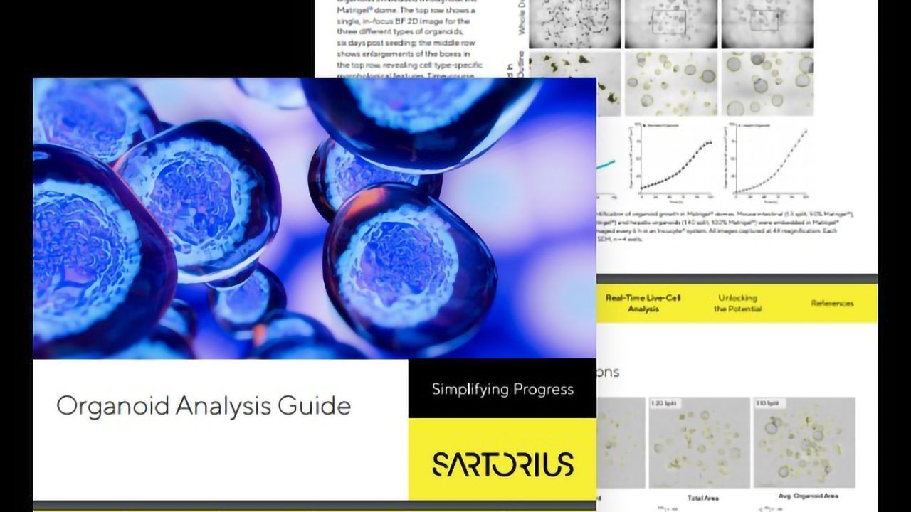 Organoid Analysis Guide