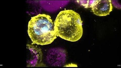 "Freeze Frame" Technique Catches Killer Protein in the Act